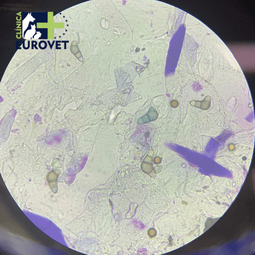parasitos intestinales al microscopio